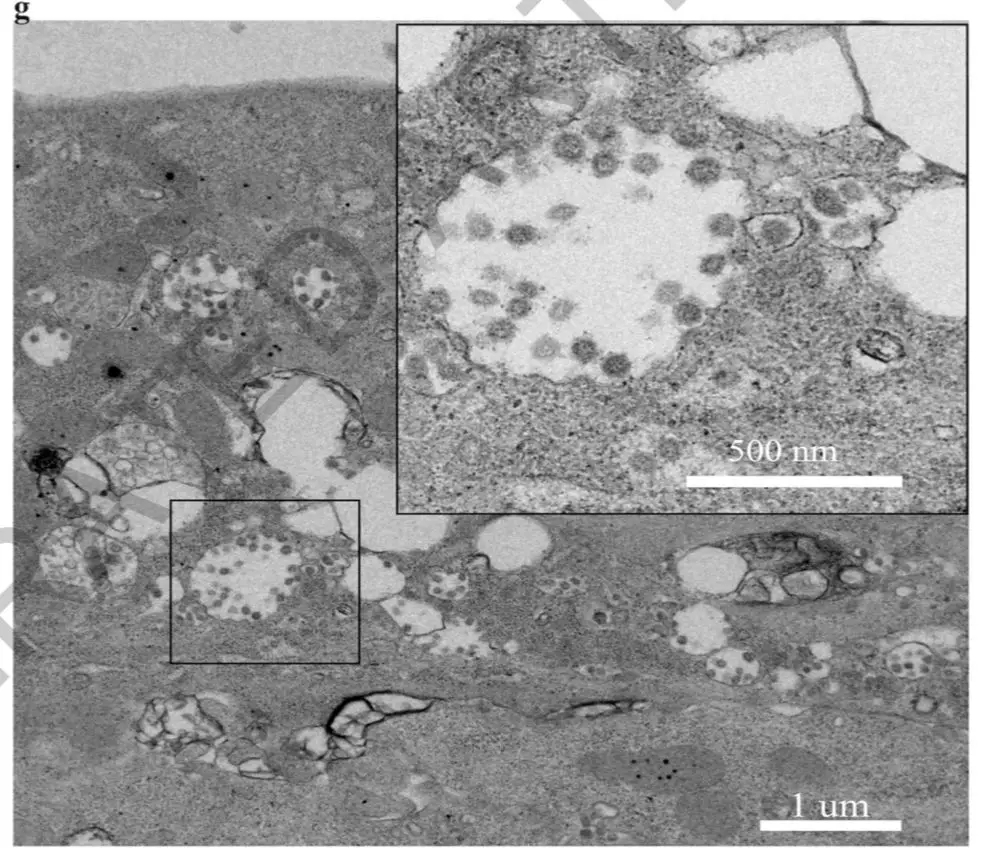 电子显微镜下可以看到被感染细胞内的病毒颗粒